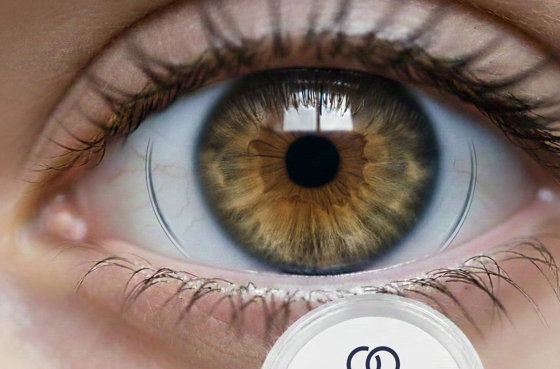 lentilles de contact - Espace Vision